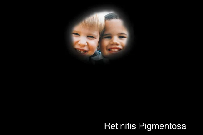 persons view who has retinitis pigmentosa photo courtesy National Eye Institute