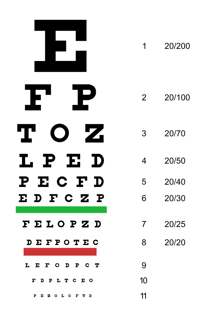 What is Legal Blindness? - ConnectCenter