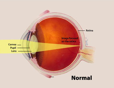 picture showing where image is focused on the retina coming through the pupil, lens, and cornea