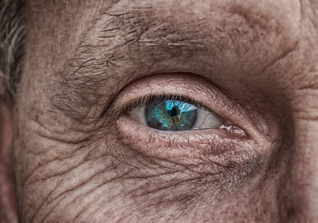Older person with Blue Eye