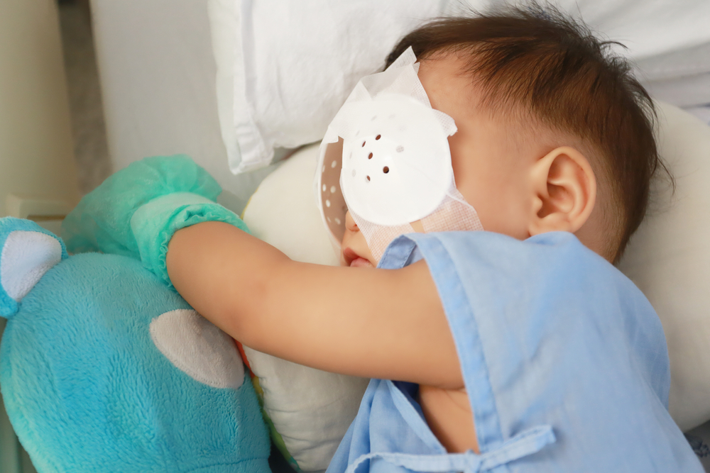 Baby after eye surgery wearing eye protection. 