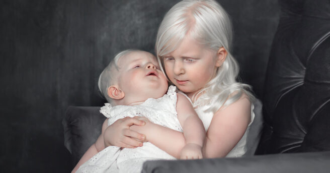 Sisters who have albinism, the older one holding and hugging the younger baby sister. 