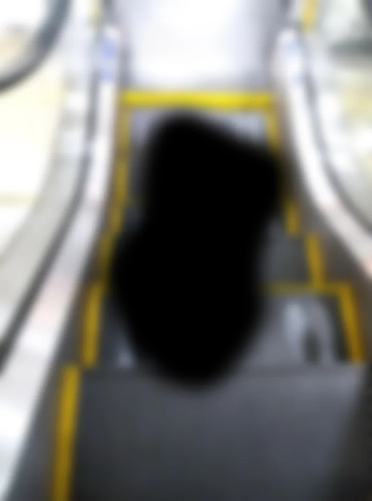 Loss of vision in the patient from ophthalmologic abnormalities in the eye exam It could be cataract, glaucoma, macular degeneration.