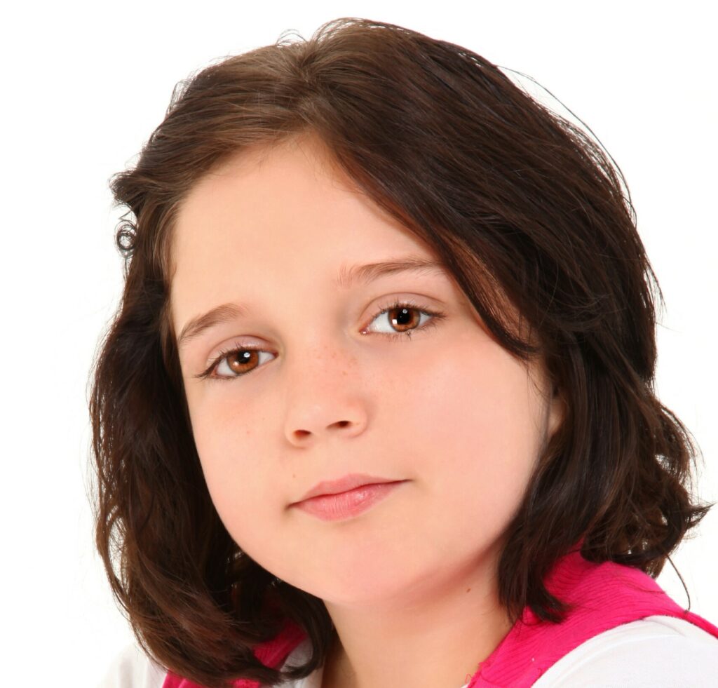 Young girl close-up with ocular prosthesis.